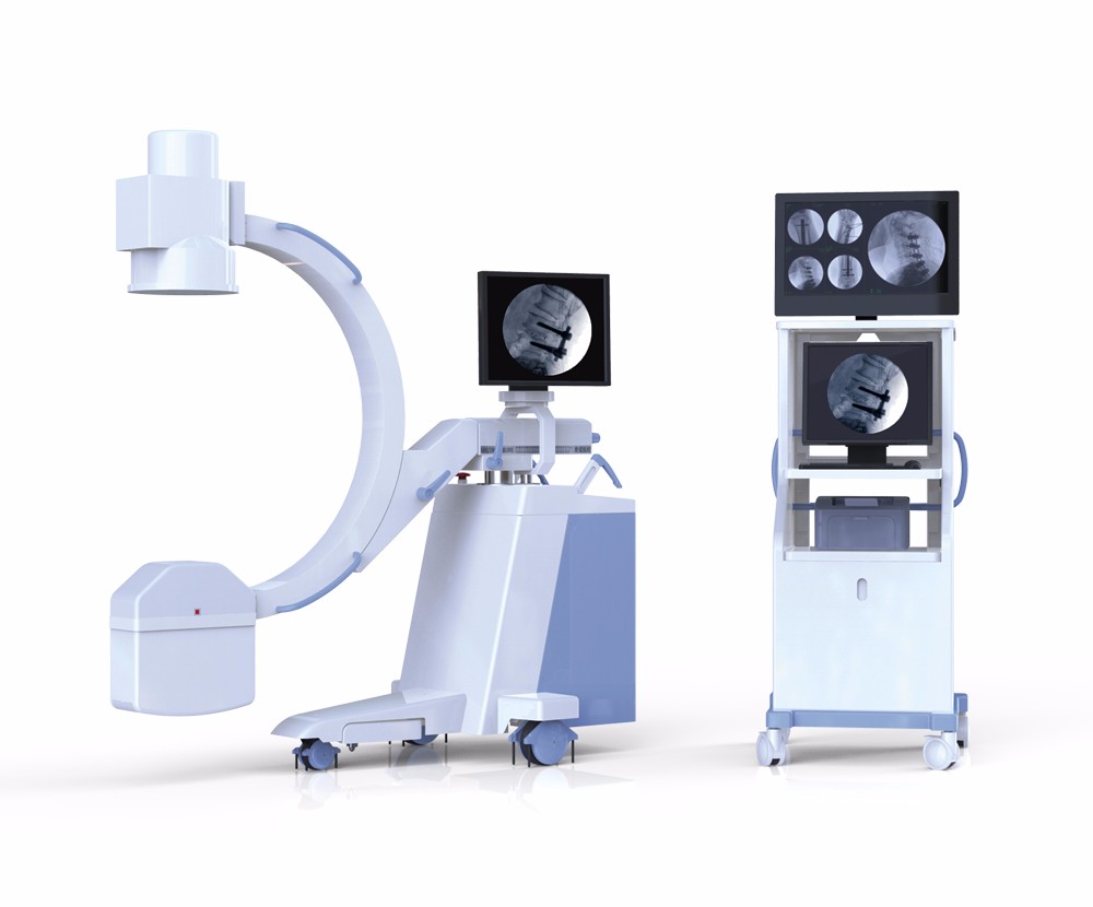 孕期做X光檢查會不會導致胎兒畸形?看這里