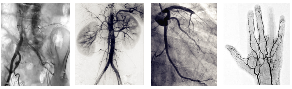 介入c臂機臨床圖片 介入c臂機臨床圖片