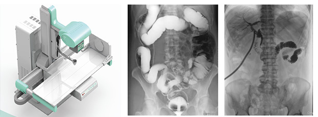 多功能動態DR影像圖 多功能動態DR影像圖