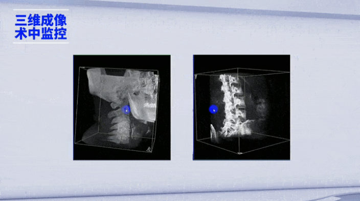 三維成像 三維成像