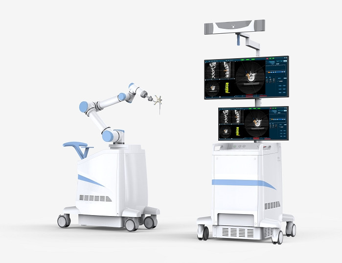 PL300B天權(quán)骨科手術(shù)機器人 PL300B天權(quán)骨科手術(shù)機器人