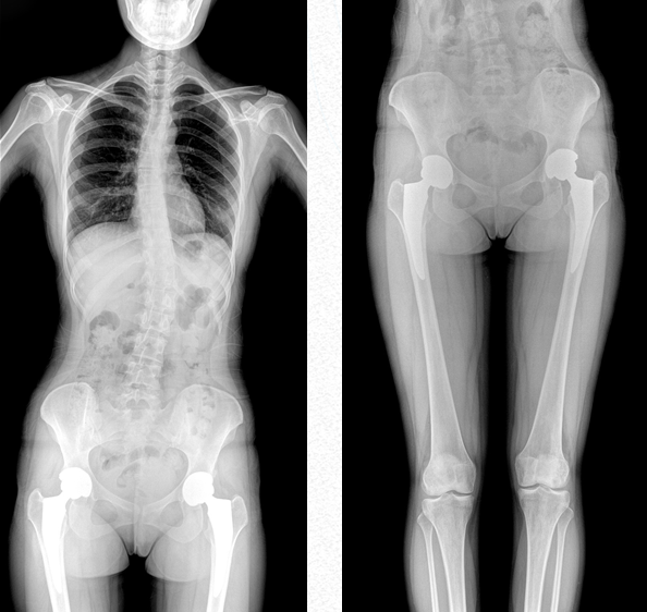 大視野平板動(dòng)態(tài)DR 大視野平板動(dòng)態(tài)DR